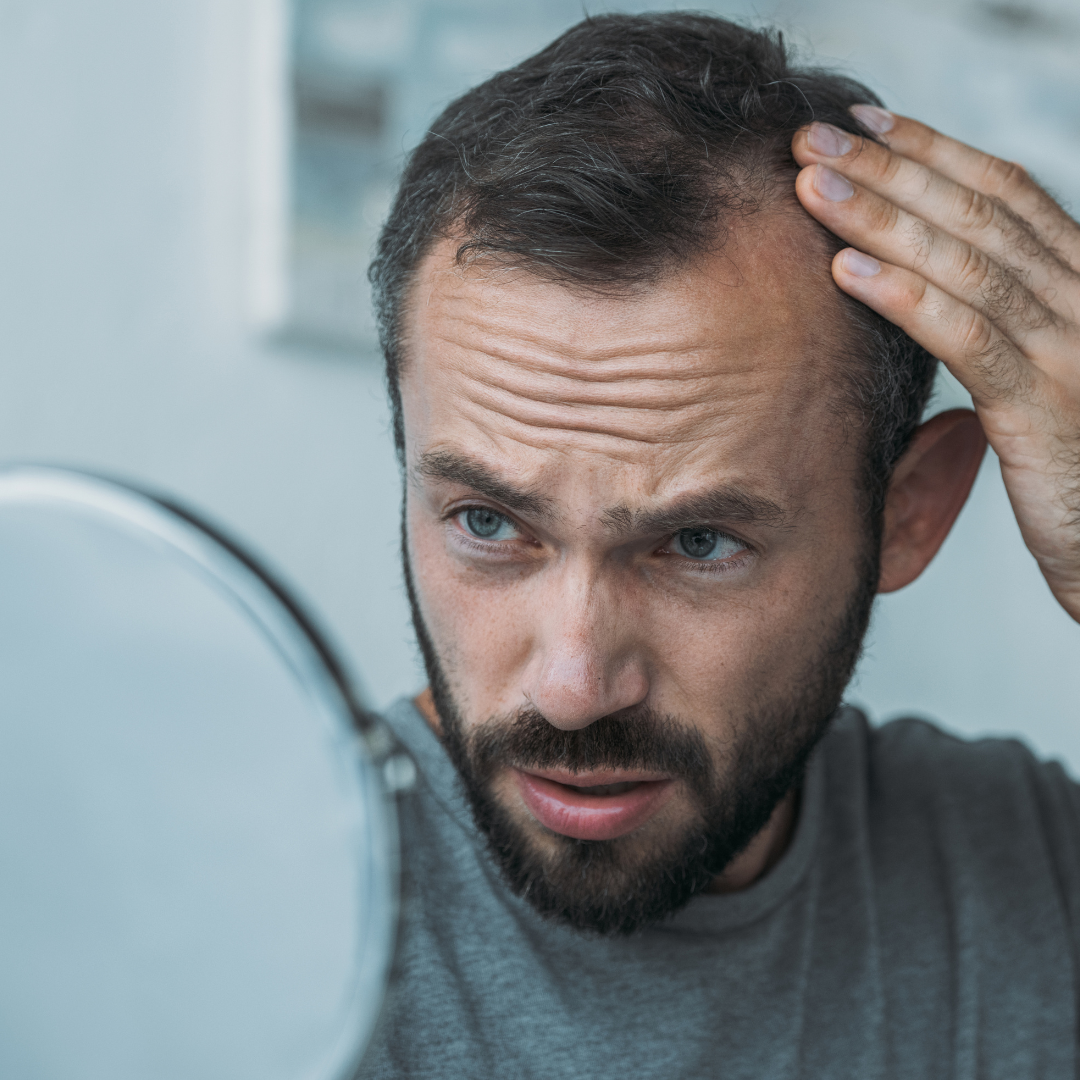a man looking at his hairline in the mirror
