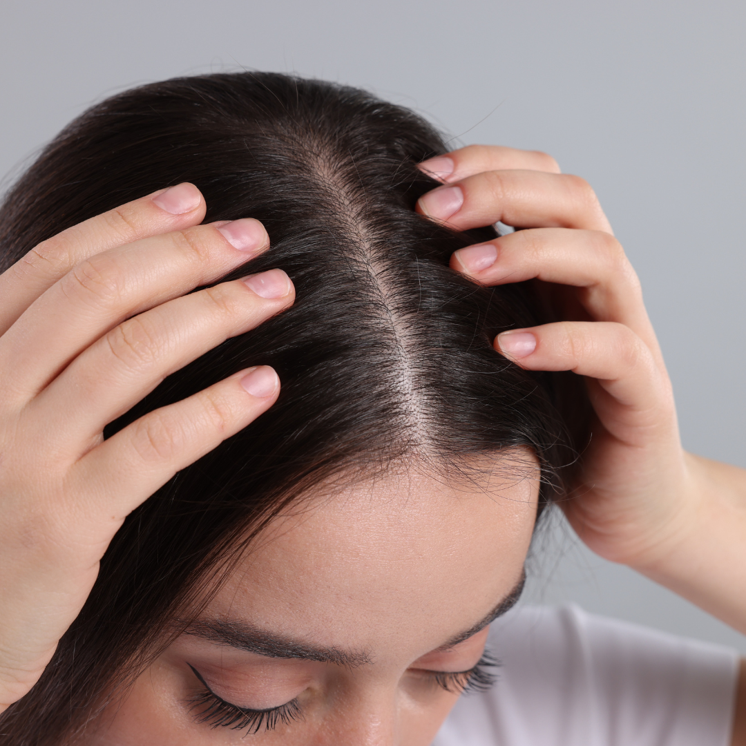 a woman revealing her scalp