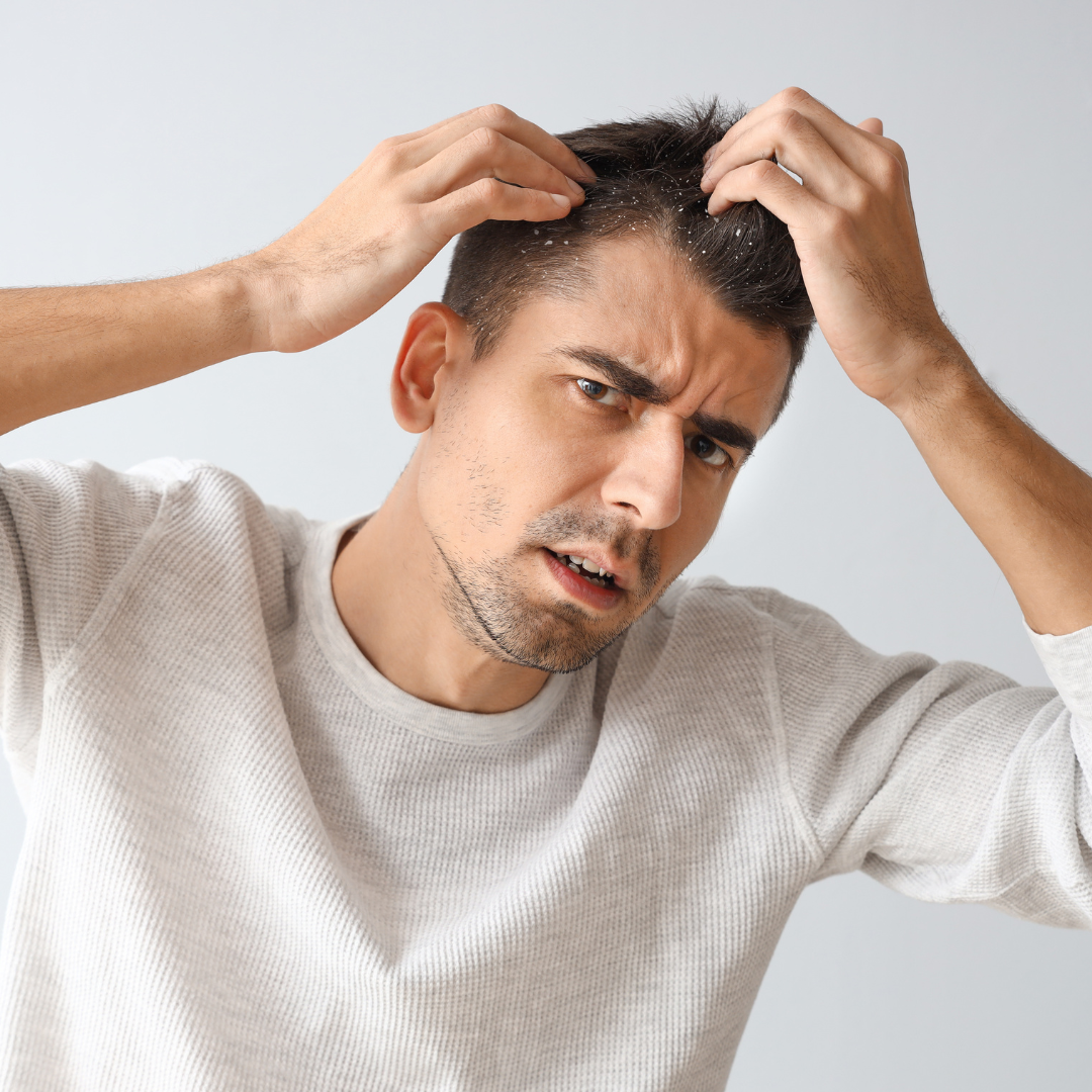 Young Man with Problem of Dandruff on Light Background