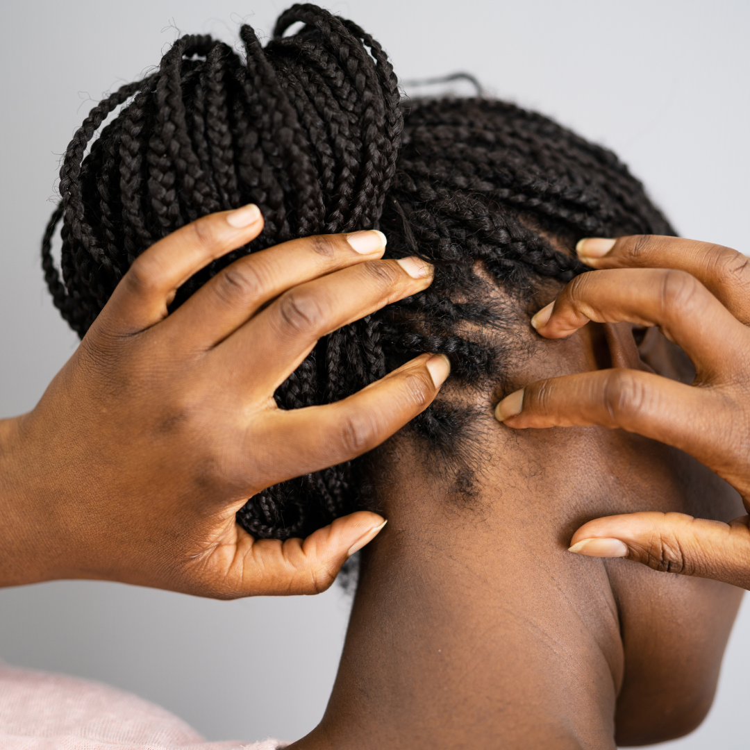 a woman with braided hair scratching her scalp