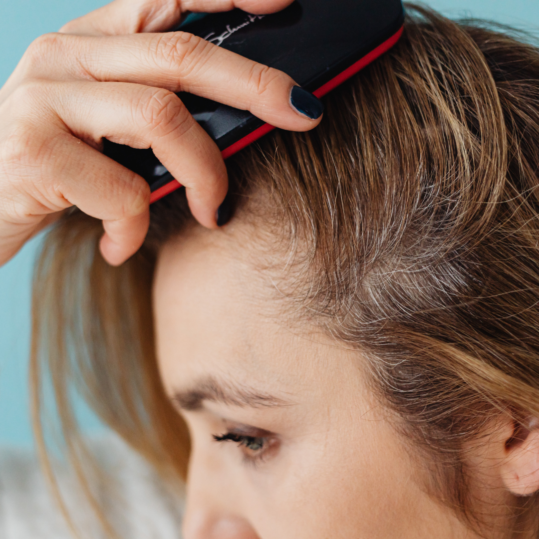 Oily Scalp + Dandruff Routine (Greasy Roots, Itch & Flakes): 7-Day Reset & 4-Week Plan