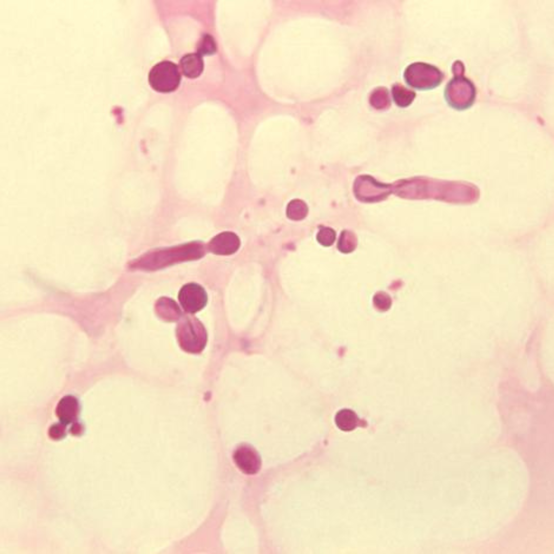 Malassezia