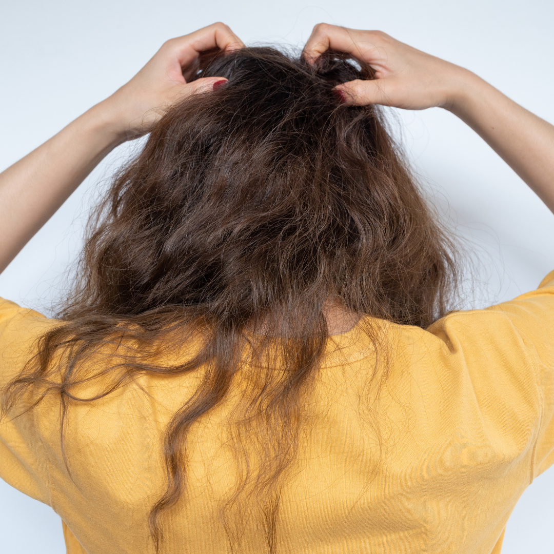 Rear view of young woman while scratching her scalp caused of itchy scalp.
