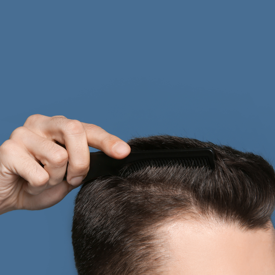 Young Man with Hair Loss Problem on Color Background