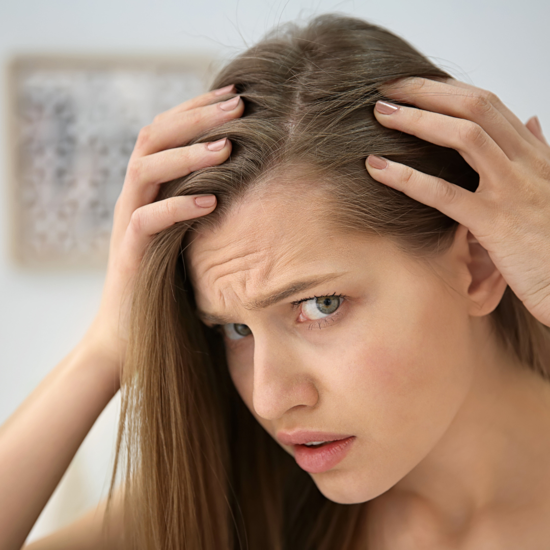 Young Woman with Hair Loss Problem