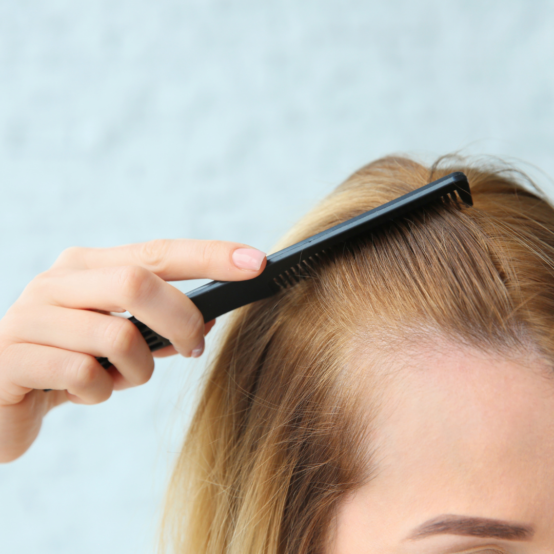 Brushing up her hair to show hairline