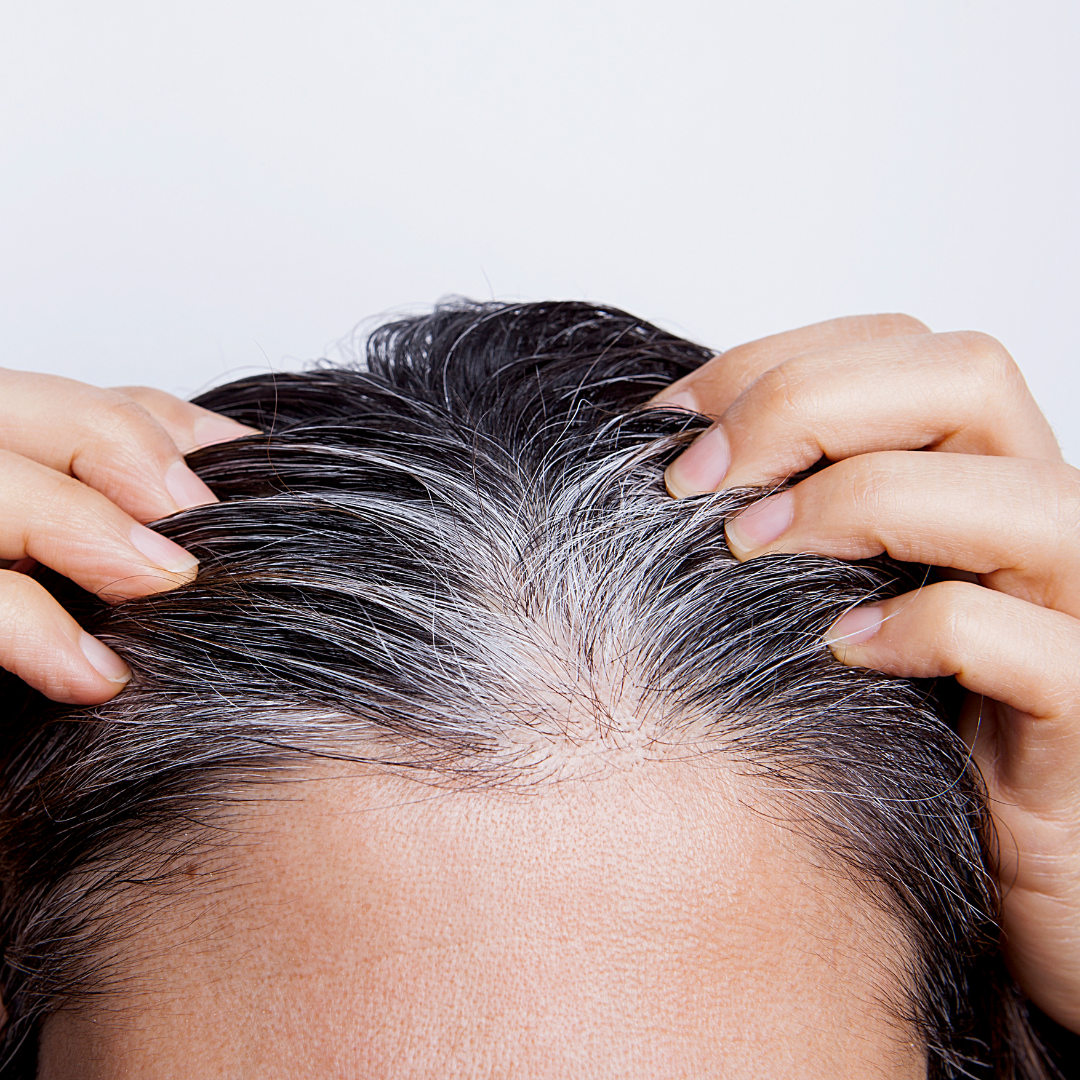 Young woman with white hair problem
