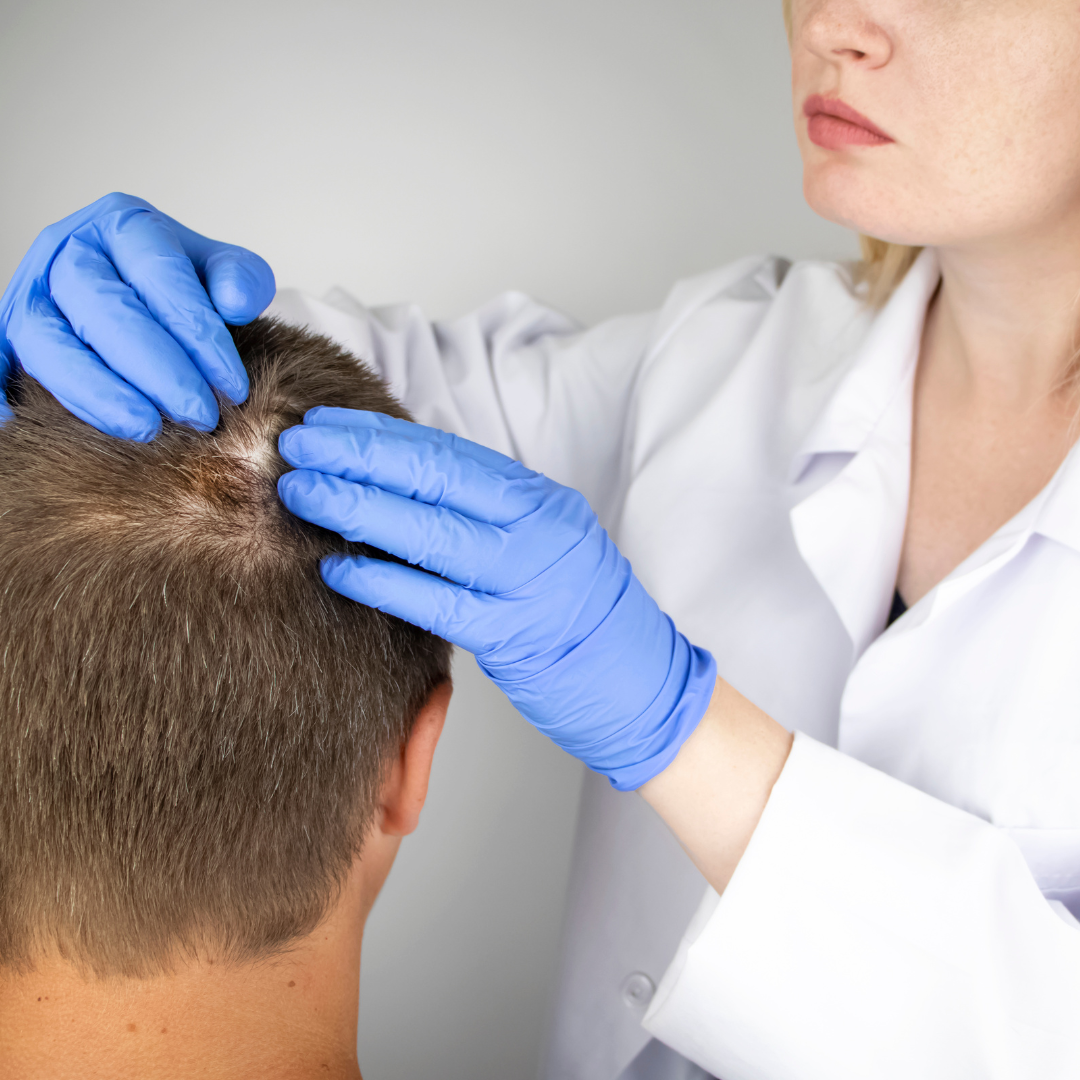 dermatologist checking at patient's scalp