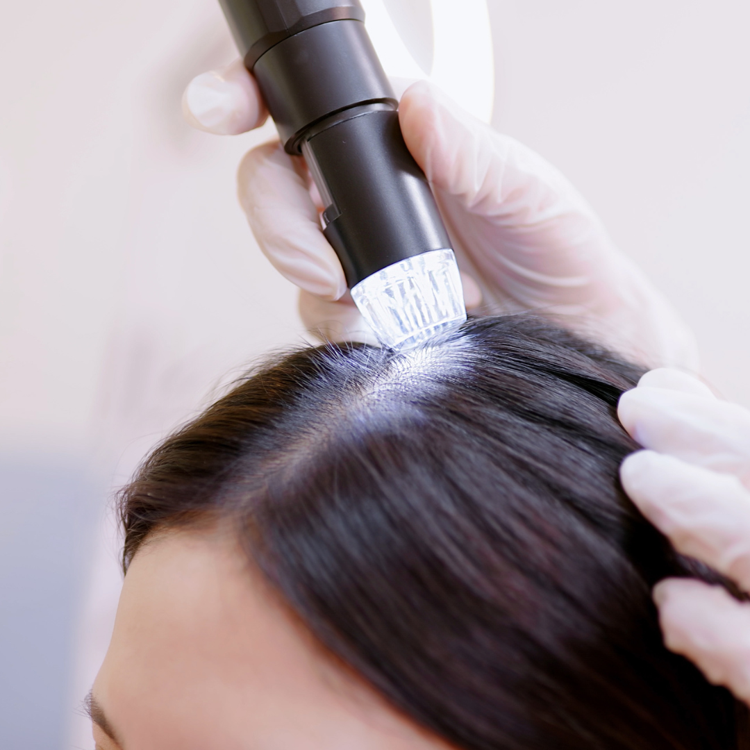doctor exam scalp using microscope