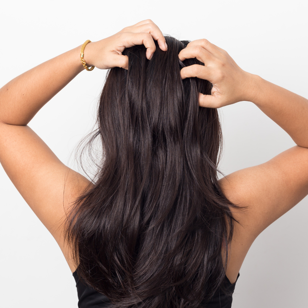 woman scratches her itchy scalp