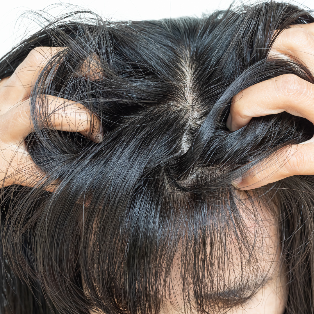 woman scratching her scalp
