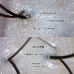 Comparison of clogged pores, follicle damage, dry flaky scalp, clean pores, restored follicle, and healthy balanced scalp on a textured surface.