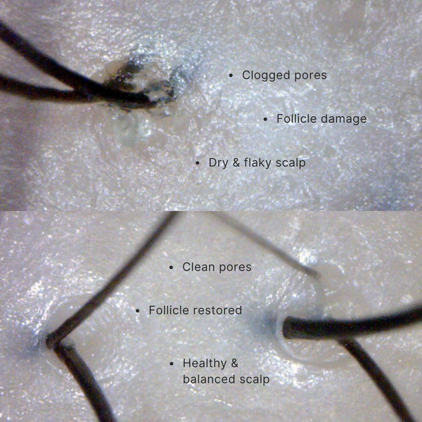 Comparison of clogged pores, follicle damage, dry flaky scalp, clean pores, restored follicle, and healthy balanced scalp on a textured surface.