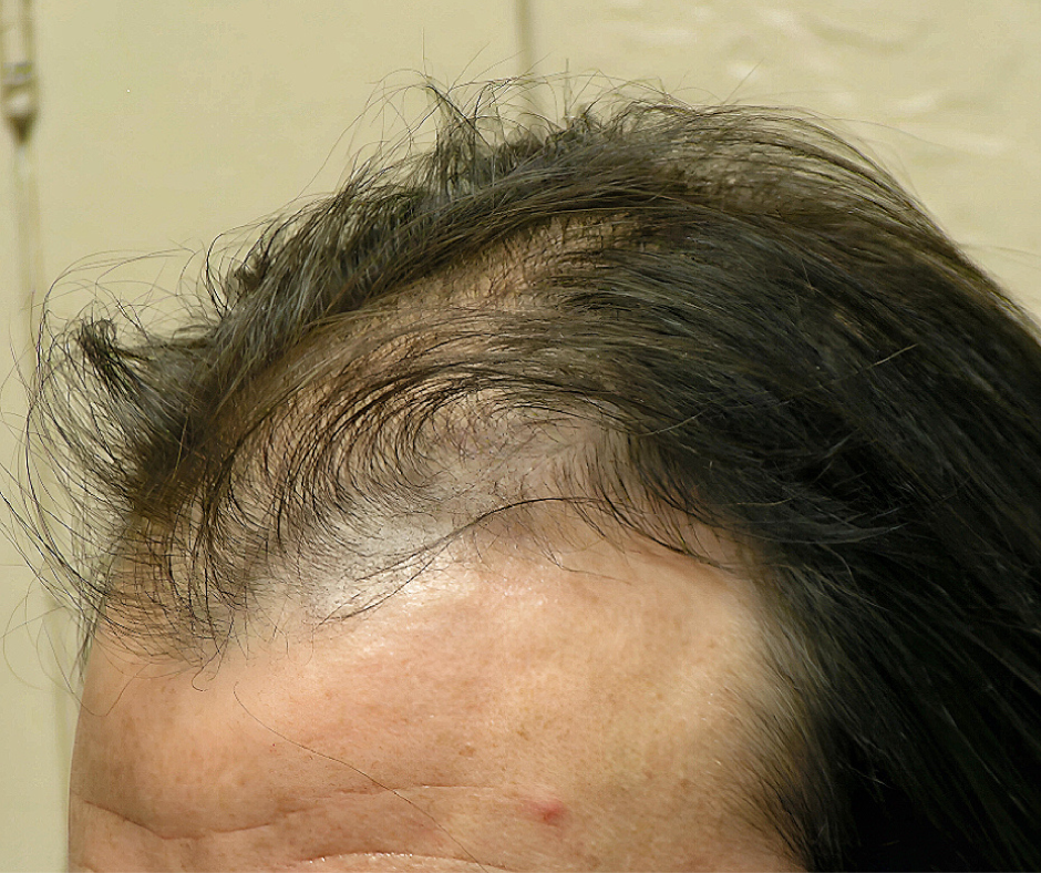 Close-up of a person's head with hair and skin visible