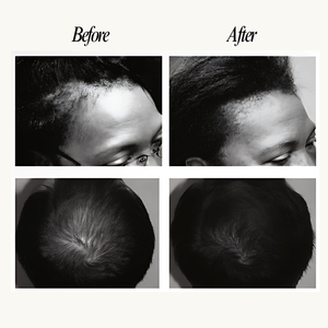 Before and after comparison of hair treatment on a person's head.