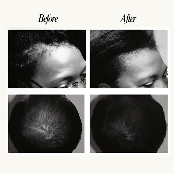 Before and after comparison of hair treatment on a person's head.
