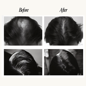 Before and after comparison of hair treatment on a person's head.