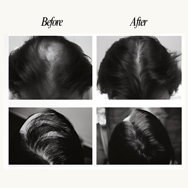 Before and after comparison of hair treatment on a person's head.