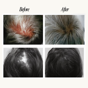 Before and after comparison of hair treatment on a person's head.