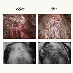 Before and after comparison of hair treatment on a person's head.