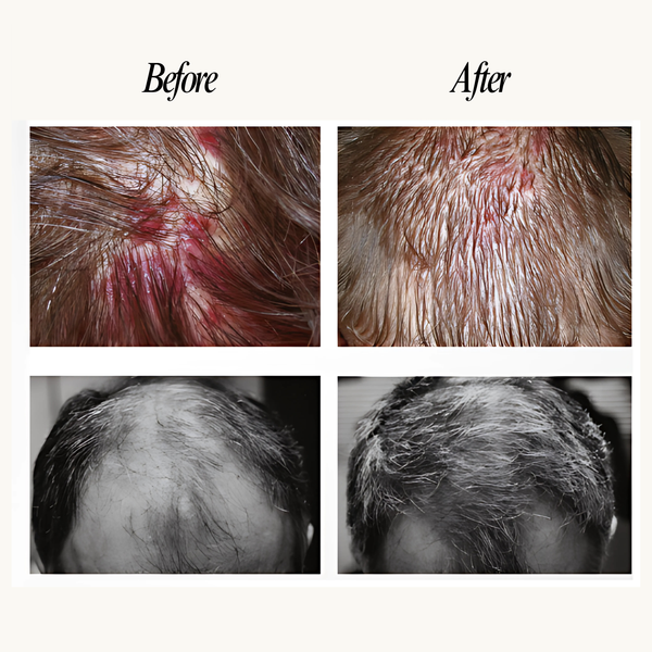 Before and after comparison of hair treatment on a person's head.